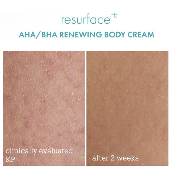 New, Skinfix Resurface+ AHA/BHA Renewing Body Cream 296 mL / 10 oz. - Picture 4 of 10